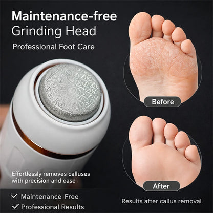 Electric Callus Remover Foot File Dry Skin Remover Dead Skin Eliminator Pedicure Exfoliator Tool for Home Foot Care 2026 New