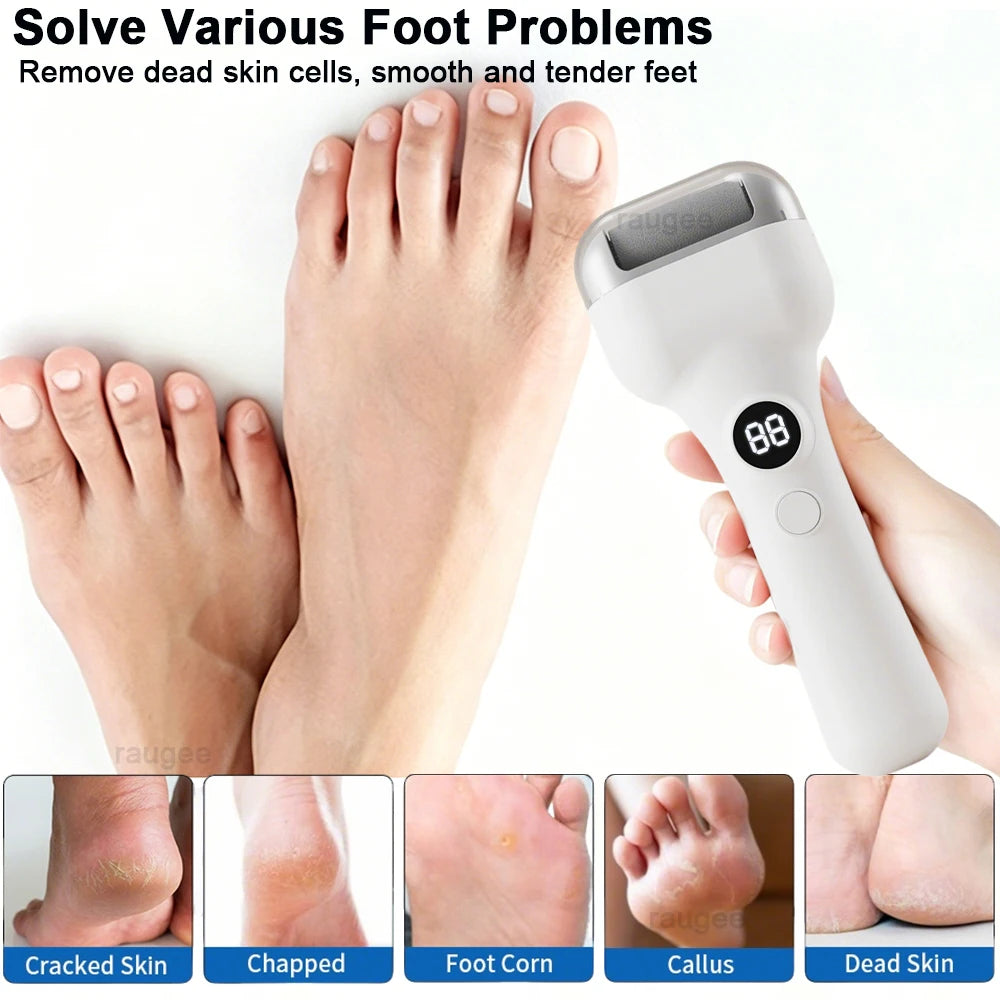 Electric Feet Callus Removers Portable Electronic Foot File Rechargeable Callus Remover for Dead Hard Cracked Dry Skin Feet Care