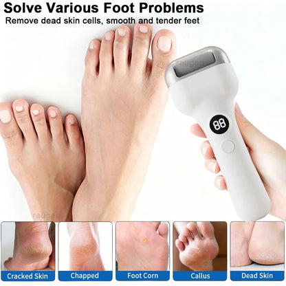 Electric Feet Callus Removers Portable Electronic Foot File Rechargeable Callus Remover for Dead Hard Cracked Dry Skin Feet Care